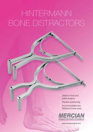 Pinzas de distracción de tobillo de Hintermann